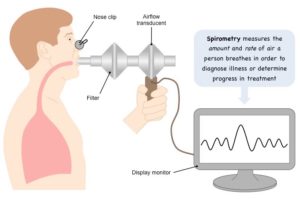 Test spirometry