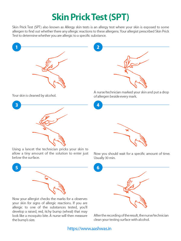 Skin Prick Test